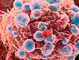 Kanser her yıl 3 bin çocuğu yakalıyor